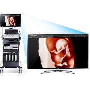 FULL 5D ultrahang készülék